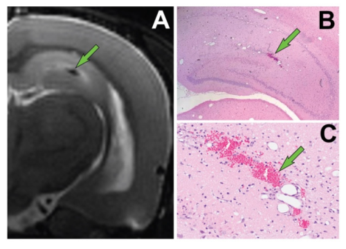 Representative of microhemorrhages in DFP rats